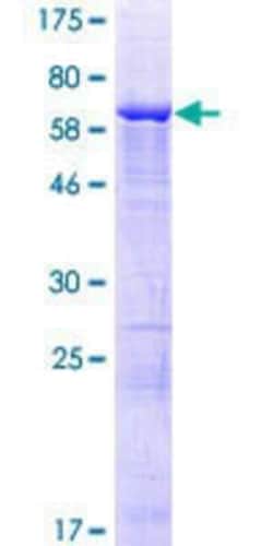 Novus Biologicals Recombinant Human TRMT9B GST (N-Term) Protein 25 &mu;g | Buy Online | Novus Biologicals&trade; | Fisher Scientific