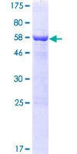 Novus Biologicals&trade;&nbsp;Recombinant Human Slain2 GST (N-Term) Protein