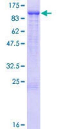 Novus Biologicals Recombinant Human KLHL1 GST (N-Term) Protein 10 &mu;g | Buy Online | Novus Biologicals&trade; | Fisher Scientific