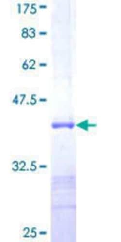 Novus Biologicals Recombinant Human SH3MD2 GST (N-Term) Protein 10 &mu;g | Buy Online | Novus Biologicals&trade; | Fisher Scientific