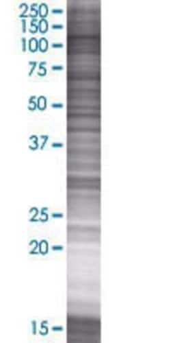Novus Biologicals&trade;&nbsp;p400 293T Cell Transient Overexpression Lysate