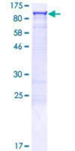 Novus Biologicals Recombinant Human CoCoA GST (N-Term) Protein 25 &mu;g | Buy Online | Novus Biologicals&trade; | Fisher Scientific