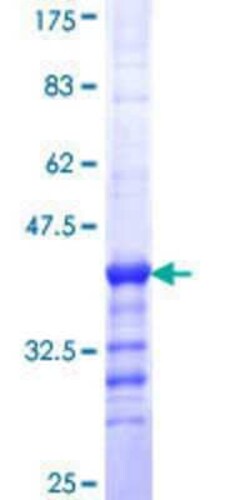 Novus Biologicals Recombinant Human PLEKHA4 GST (N-Term) Protein 10 &mu;g | Buy Online | Novus Biologicals&trade; | Fisher Scientific