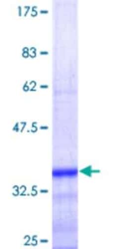 Novus Biologicals Recombinant Human GPAM GST (N-Term) Protein 25 &mu;g | Buy Online | Novus Biologicals&trade; | Fisher Scientific