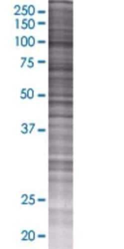 Novus Biologicals GPAM 293T Cell Transient Overexpression Lysate 0.1 mL | Buy Online | Novus Biologicals&trade; | Fisher Scientific