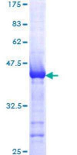 Novus Biologicals Recombinant Human Als2 GST (N-Term) Protein 10 &mu;g | Buy Online | Novus Biologicals&trade; | Fisher Scientific