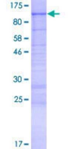Novus Biologicals Recombinant Human KIAA1586 GST (N-Term) Protein 2 &mu;g | Buy Online | Novus Biologicals&trade; | Fisher Scientific