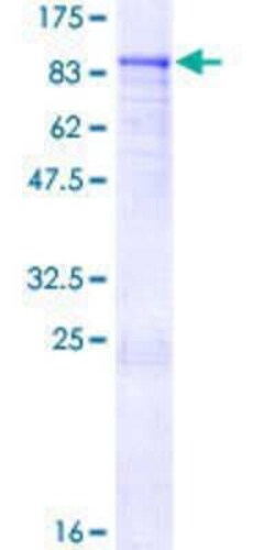 Novus Biologicals Recombinant Human ZNF317 GST (N-Term) Protein 25 &mu;g | Buy Online | Novus Biologicals&trade; | Fisher Scientific