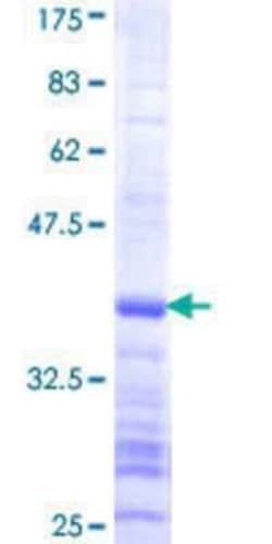Novus Biologicals Recombinant Human USP37 GST (N-Term) Protein 10 &mu;g | Buy Online | Novus Biologicals&trade; | Fisher Scientific