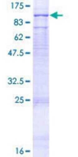 Novus Biologicals Recombinant Human FANCM GST (N-Term) Protein 2 &mu;g | Buy Online | Novus Biologicals&trade; | Fisher Scientific