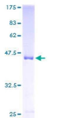 Novus Biologicals Recombinant Human shootin-1 GST (N-Term) Protein 25 &mu;g | Buy Online | Novus Biologicals&trade; | Fisher Scientific