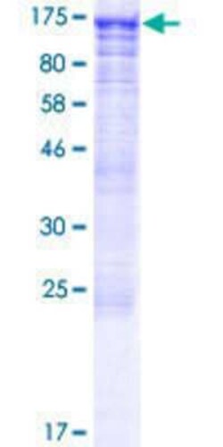 Novus Biologicals Recombinant Human CWC22 GST (N-Term) Protein 2 &mu;g | Buy Online | Novus Biologicals&trade; | Fisher Scientific