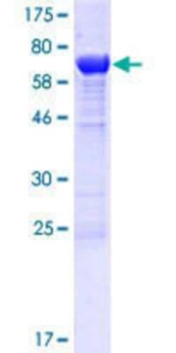 Novus Biologicals Recombinant Human TLDC1 GST (N-Term) Protein 10 &mu;g | Buy Online | Novus Biologicals&trade; | Fisher Scientific