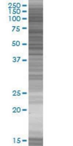 Novus Biologicals&trade;&nbsp;MIER1 293T Cell Transient Overexpression Lysate