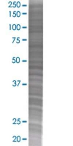 Novus Biologicals Semaphorin 4G 293T Cell Transient Overexpression Lysate 0.1 mL | Buy Online | Novus Biologicals&trade; | Fisher Scientific