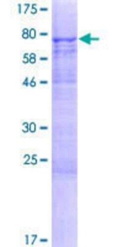 Novus Biologicals Recombinant Human METTL14 GST (N-Term) Protein 2 &mu;g | Buy Online | Novus Biologicals&trade; | Fisher Scientific