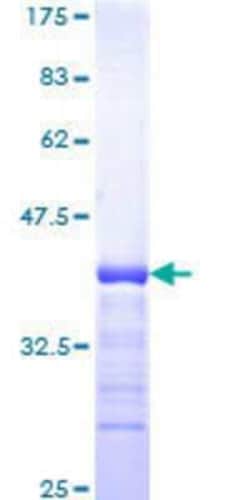 Novus Biologicals Recombinant Human RB associated KRAB repressor GST (N-Term) Protein 10 &mu;g | Buy Online | Novus Biologicals&trade; | Fisher Scientific