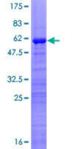 Novus Biologicals Recombinant Human Ocular development associated gene GST (N-Term) Protein 10 &mu;g | Buy Online | Novus Biologicals&trade; | Fisher Scientific