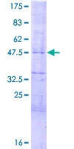 Novus Biologicals Recombinant Human HES-4 GST (N-Term) Protein 2 &mu;g | Buy Online | Novus Biologicals&trade; | Fisher Scientific