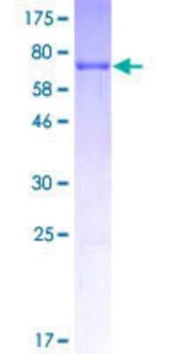 Novus Biologicals Recombinant Human DBC1/p30 GST (N-Term) Protein 25 &mu;g | Buy Online | Novus Biologicals&trade; | Fisher Scientific