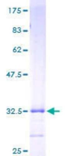 Novus Biologicals Recombinant Human Hepcidin Antimicrobial Peptide GST (N-Term) Protein 25 &mu;g | Buy Online | Novus Biologicals&trade; | Fisher Scientific