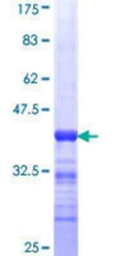 Novus Biologicals Recombinant Human GRHL3 GST (N-Term) Protein 25 &mu;g | Buy Online | Novus Biologicals&trade; | Fisher Scientific