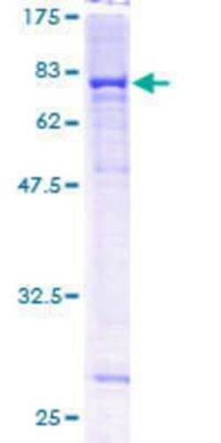 Novus Biologicals Recombinant Human Cytochrome P450 4F11 GST (N-Term) Protein 10 &mu;g | Buy Online | Novus Biologicals&trade; | Fisher Scientific