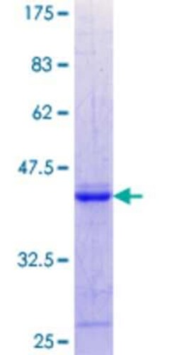 Novus Biologicals Recombinant Human WFDC1 GST (N-Term) Protein 10 &mu;g | Buy Online | Novus Biologicals&trade; | Fisher Scientific
