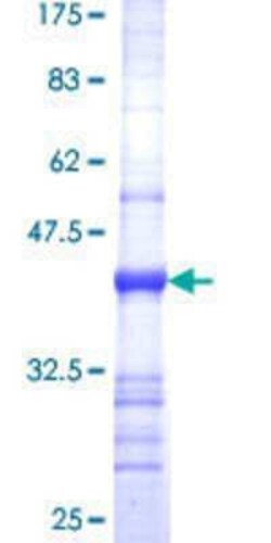 Novus Biologicals Recombinant Human PLEKHB1/PHR1 GST (N-Term) Protein 10 &mu;g | Buy Online | Novus Biologicals&trade; | Fisher Scientific