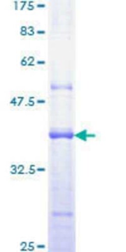 Novus Biologicals Recombinant Human CARD12 GST (N-Term) Protein 10 &mu;g | Buy Online | Novus Biologicals&trade; | Fisher Scientific