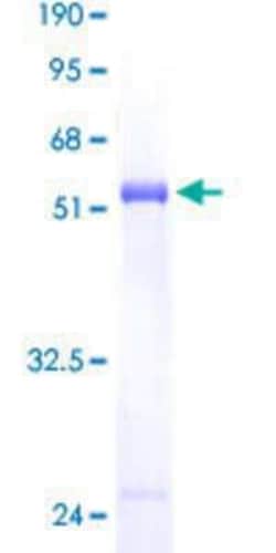 Novus Biologicals Recombinant Human PCTP GST (N-Term) Protein 25 &mu;g | Buy Online | Novus Biologicals&trade; | Fisher Scientific