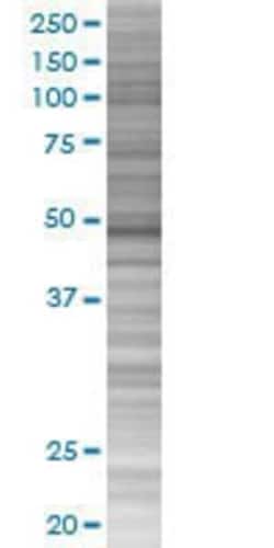 Novus Biologicals™ EZFIT/ZNF71 293T Cell Transient Overexpression Lysate