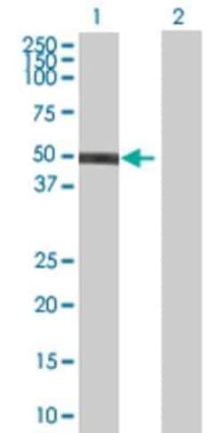 Novus Biologicals EZFIT/ZNF71 293T Cell Transient Overexpression Lysate 0,1 mL | Buy Online | Novus Biologicals&trade; | Fisher Scientific