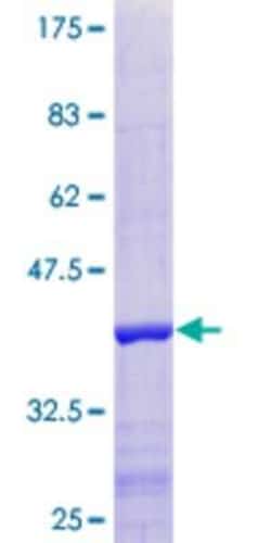 Novus Biologicals Recombinant Human SSBIP1/SOSS-C GST (N-Term) Protein 10 &mu;g | Buy Online | Novus Biologicals&trade; | Fisher Scientific