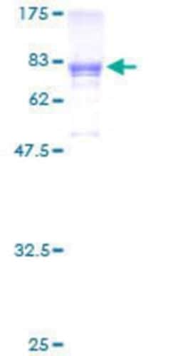 Novus Biologicals Recombinant Human PRUNE GST (N-Term) Protein 10 &mu;g | Buy Online | Novus Biologicals&trade; | Fisher Scientific