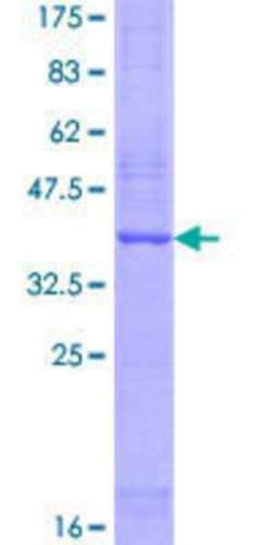 Novus Biologicals Recombinant Human DC2 GST (N-Term) Protein 10 &mu;g | Buy Online | Novus Biologicals&trade; | Fisher Scientific