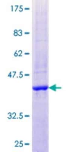 Novus Biologicals Recombinant Human DNASE2B GST (N-Term) Protein 25 &mu;g | Buy Online | Novus Biologicals&trade; | Fisher Scientific