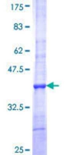 Novus Biologicals Recombinant Human DNASE2B GST (N-Term) Protein 25 &mu;g | Buy Online | Novus Biologicals&trade; | Fisher Scientific