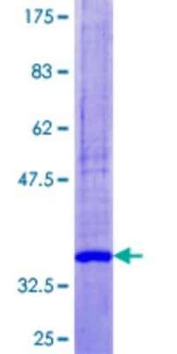Novus Biologicals Recombinant Human SELK GST (N-Term) Protein 10 &mu;g | Buy Online | Novus Biologicals&trade; | Fisher Scientific