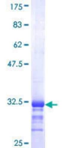 Novus Biologicals&trade;&nbsp;Recombinant Human SELK GST (N-Term) Protein