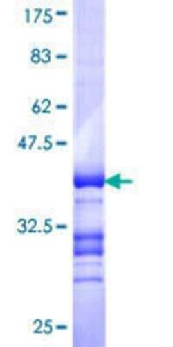 Novus Biologicals Recombinant Human DMRT3 GST (N-Term) Protein 25 &mu;g | Buy Online | Novus Biologicals&trade; | Fisher Scientific