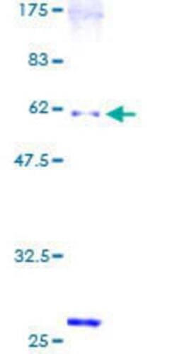 Novus Biologicals Recombinant Human Snx6 GST (N-Term) Protein 25 &mu;g | Buy Online | Novus Biologicals&trade; | Fisher Scientific