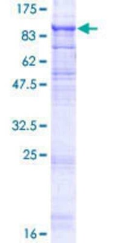Novus Biologicals Recombinant Human TMEM8 GST (N-Term) Protein 10 &mu;g | Buy Online | Novus Biologicals&trade; | Fisher Scientific