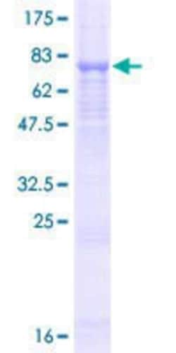 Novus Biologicals Recombinant Human Eva-1 Homolog C GST (N-Term) Protein 10 &mu;g | Buy Online | Novus Biologicals&trade; | Fisher Scientific