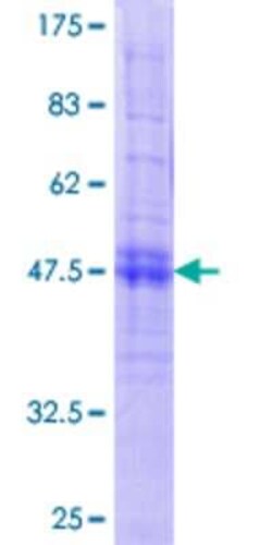 Novus Biologicals Recombinant Human CACNG7 GST (N-Term) Protein 10 &mu;g | Buy Online | Novus Biologicals&trade; | Fisher Scientific