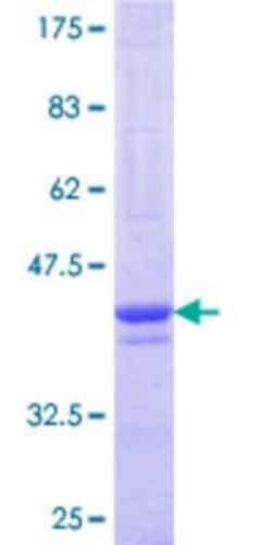 Novus Biologicals Recombinant Human TAPP1/PLEKHA1 GST (N-Term) Protein 25 &mu;g | Buy Online | Novus Biologicals&trade; | Fisher Scientific