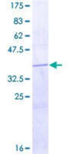 Novus Biologicals Recombinant Human Histamine H4R GST (N-Term) Protein 2 &mu;g | Buy Online | Novus Biologicals&trade; | Fisher Scientific