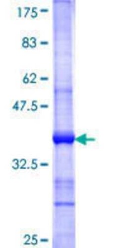 Novus Biologicals Recombinant Human ALOXE3 GST (N-Term) Protein 10 &mu;g | Buy Online | Novus Biologicals&trade; | Fisher Scientific