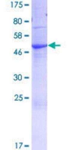 Novus Biologicals Recombinant Human FAM3A GST (N-Term) Protein 10 &mu;g | Buy Online | Novus Biologicals&trade; | Fisher Scientific