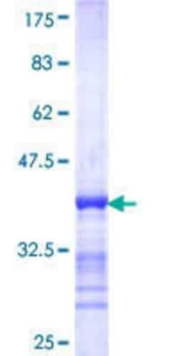Novus Biologicals Recombinant Human TSKS GST (N-Term) Protein 25 &mu;g | Buy Online | Novus Biologicals&trade; | Fisher Scientific